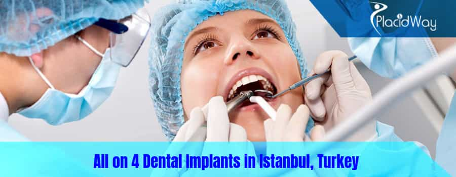 All on 4 Dental Implants in Istanbul, Turkey